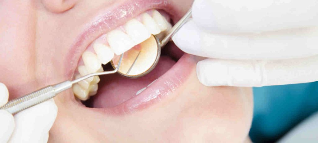 Stomatologia estetyczna Toruń -zabiegi DSD implanty wybielanie zębów
